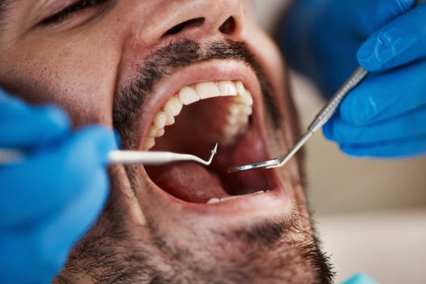 Best Emergency Treatment for Jaw Pain or Injury in Carbondale, KS